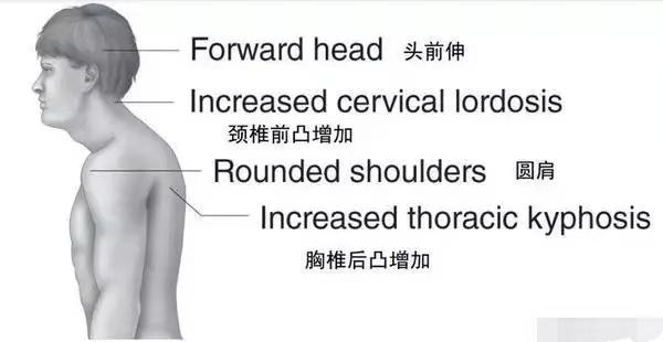 如何改善不良姿态？通过这些技巧，滋养脊柱，让你身姿更挺拔