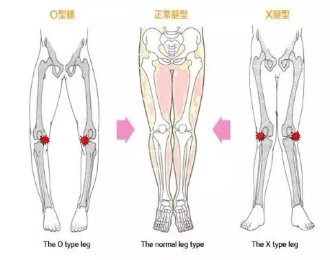 初学瑜伽如何保护膝盖？学会避免过度伸展是关键，尤其要注意啦