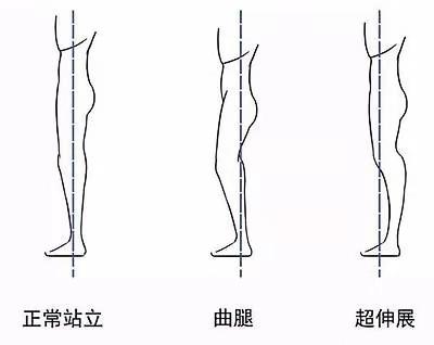 初学瑜伽如何保护膝盖？学会避免过度伸展是关键，尤其要注意啦