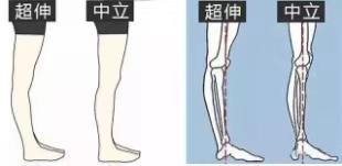 初学瑜伽如何保护膝盖？学会避免过度伸展是关键，尤其要注意啦