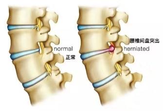 练习瑜伽前屈，如何保护腰椎避免损伤，这些技巧和常识你要知道