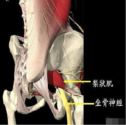 梨状肌，可能是坐骨神经痛和下背部痛的根源，一定要重视起来