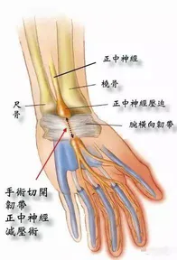 手腕受伤如何练瑜伽？这些技巧和调整方法你要知道！