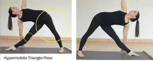 如何理解瑜伽老师说的“膝盖微弯曲”？你做对了吗？