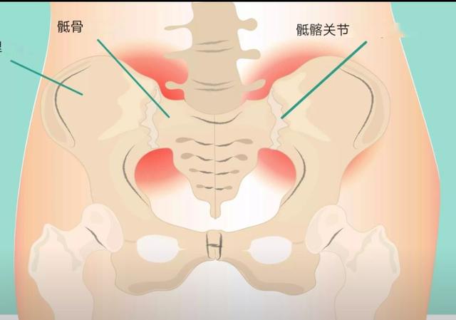 练瑜伽，如何加强盆底肌？这几个动作要常练