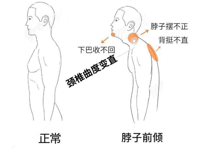 一个能轻易毁掉颈椎的坏习惯，基本人人每天都在做！(附肩颈瑜伽)