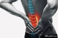 身体这个位置紧张，是造成腰痛的主要原因，男女都一样！