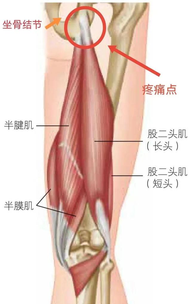 不要等在瑜伽前屈体式中受伤了，才明白这些！