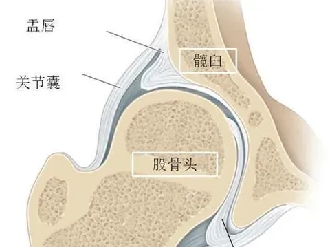 练瑜伽：为什么来到竖叉神猴式总感觉髋部有强烈拉扯感？